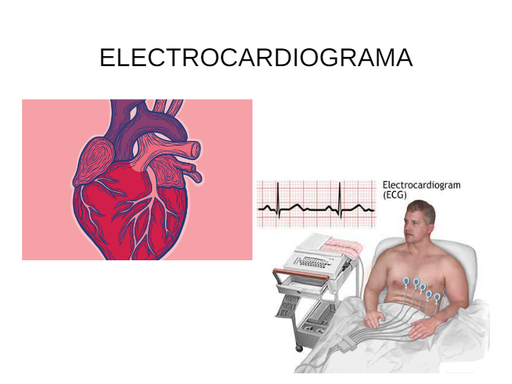 EKG Semio- 2021.ppt